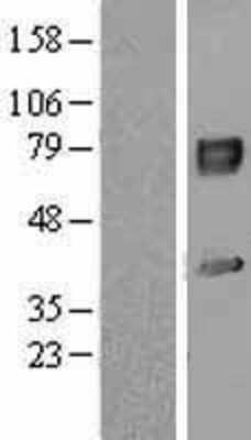 Western Blot: IL-1 RAcP/IL-1 R3 Overexpression Lysate [NBL1-11929]