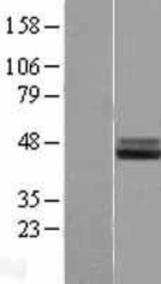 Western Blot: IL-1 RAcP/IL-1 R3 Overexpression Lysate [NBL1-11930]