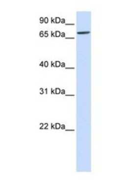 Western Blot: IL1RAPL2 Antibody [NBP1-69275]