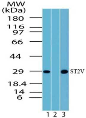 Western Blot: ST2/IL-33R Antibody [NBP2-24706]