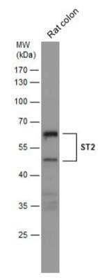 Western Blot: ST2/IL-33R Antibody [NBP2-53096]