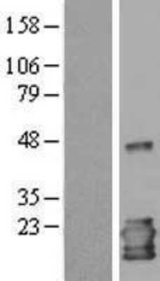 Western Blot: IL-1ra/IL-1F3/IL1RN Overexpression Lysate [NBL1-11933]