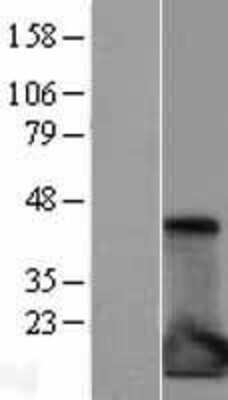 Western Blot: IL-1ra/IL-1F3/IL1RN Overexpression Lysate [NBL1-11934]