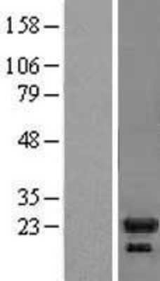 Western Blot: IL-1ra/IL-1F3/IL1RN Overexpression Lysate [NBL1-11935]