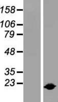 Western Blot: IL-1ra/IL-1F3/IL1RN Overexpression Lysate [NBL1-11936]