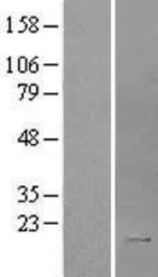 Western Blot: IL-2 Overexpression Lysate [NBL1-11937]