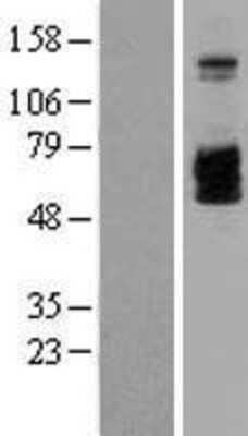 Western Blot: IL-2 R beta Overexpression Lysate [NBL1-11948]