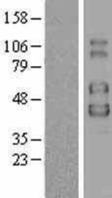 Western Blot: Common gamma Chain/IL-2 R gamma Overexpression Lysate [NBL1-11949]