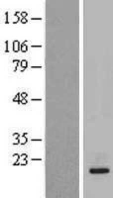 Western Blot: IL-20 Overexpression Lysate [NBP2-06758]