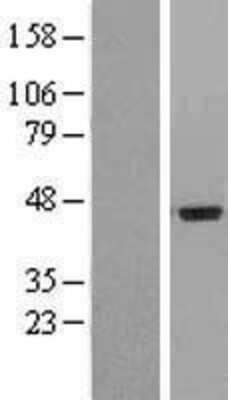 Western Blot: IL-20R alpha Overexpression Lysate [NBP2-10320]