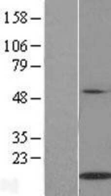 Western Blot: IL-21 Overexpression Lysate [NBP2-06520]