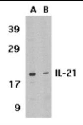 Western Blot: IL-21 Antibody Blocking Peptide [NBP1-76740PEP]