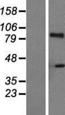 Western Blot: IL-21R Overexpression Lysate [NBP2-04935]