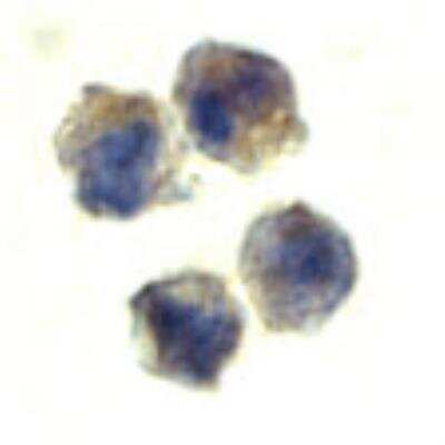 Immunocytochemistry/ Immunofluorescence: IL-22 Antibody [NBP2-31215]