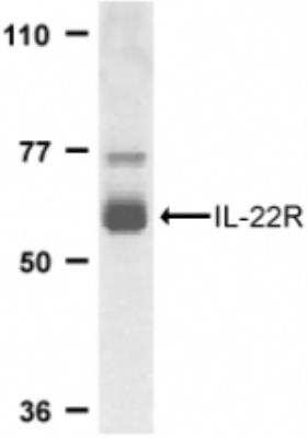 Western Blot: IL-22 Antibody [NBP2-31215]