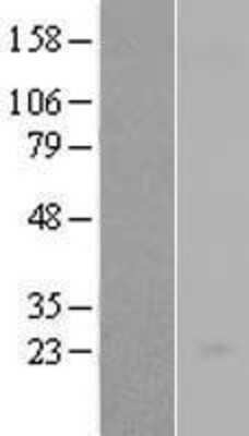 Western Blot: IL-23A/IL-23 P19 Overexpression Lysate [NBL1-11943]