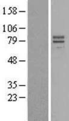 Western Blot: IL-23R Overexpression Lysate [NBL1-11944]