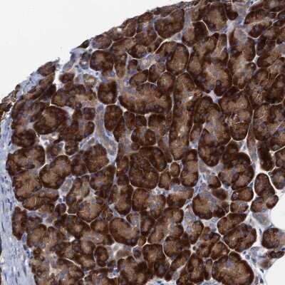 Immunohistochemistry: SF20/MYDGF Antibody [NBP2-48750]