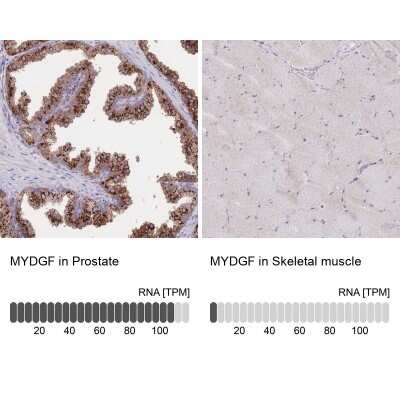 Immunohistochemistry-Paraffin: SF20/MYDGF Antibody [NBP2-48856]