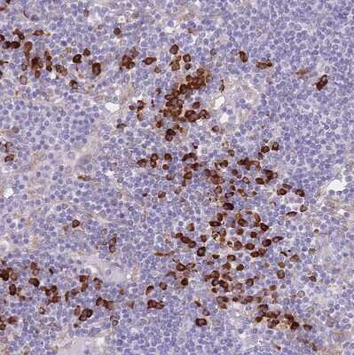 Immunohistochemistry-Paraffin: SF20/MYDGF Antibody [NBP2-48856]