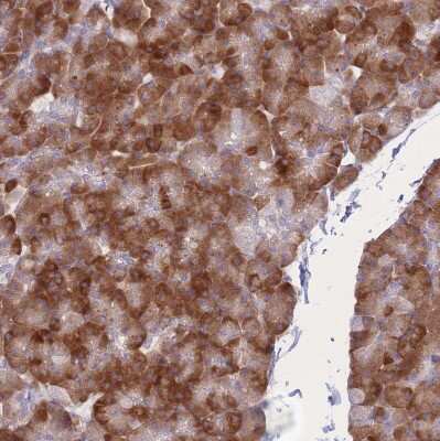 Immunohistochemistry-Paraffin: SF20/MYDGF Antibody [NBP2-48856]