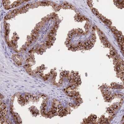 Immunohistochemistry-Paraffin: SF20/MYDGF Antibody [NBP2-48856]