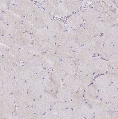 Immunohistochemistry-Paraffin: SF20/MYDGF Antibody [NBP2-48856]