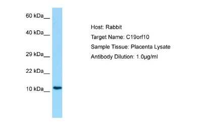 Western Blot: SF20/MYDGF Antibody [NBP1-98493]