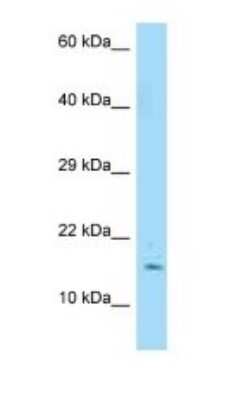 Western Blot: SF20/MYDGF Antibody [NBP1-98494]