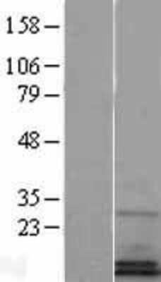 Western Blot: SF20/MYDGF Overexpression Lysate [NBP2-04376]