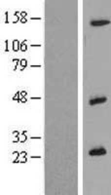 Western Blot: IL-26/AK155 Overexpression Lysate [NBP2-06805]