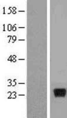 Western Blot: IL-28A/IFN-lambda 2 Overexpression Lysate [NBP2-05197]