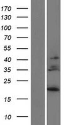 Western Blot: IL-28B/IFN-lambda 3 Overexpression Lysate [NBP2-05198]