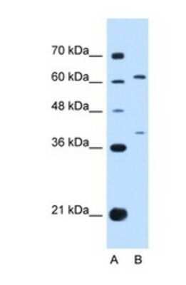 Western Blot: IL-28R alpha/IFN-lambda R1 Antibody [NBP1-69636]