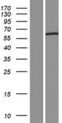 Western Blot: IL-28R alpha/IFN-lambda R1 Overexpression Lysate [NBP2-05147]