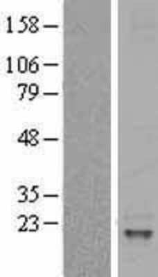 Western Blot: IL-31 Overexpression Lysate [NBL1-11951]