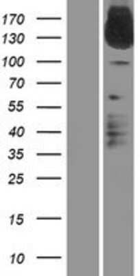 Western Blot: IL-31RA Overexpression Lysate [NBP2-05597]