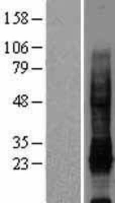 Western Blot: IL-32 Overexpression Lysate [NBL1-11952]