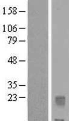 Western Blot: IL-32 Overexpression Lysate [NBL1-11953]