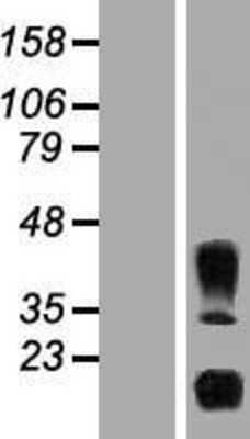 Western Blot: IL-32 Overexpression Lysate [NBP2-08699]