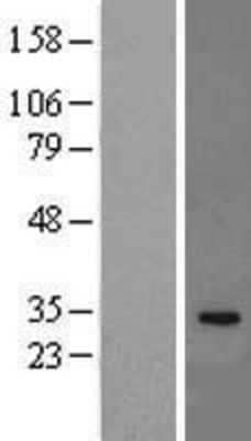 Western Blot: IL-33 Overexpression Lysate [NBL1-11954]