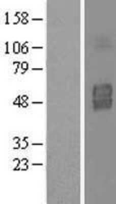 Western Blot: IL-3R alpha/CD123 Overexpression Lysate [NBL1-11956]