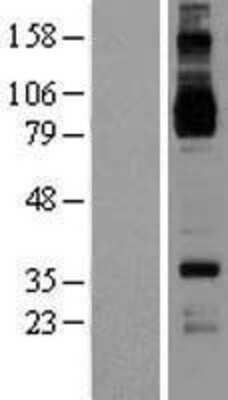 Western Blot: IL-4R alpha Overexpression Lysate [NBL1-11958]