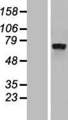 Western Blot: IL-4I1 Overexpression Lysate [NBP2-05157]