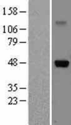 Western Blot: IL-5R alpha/CD125 Overexpression Lysate [NBL1-11960]