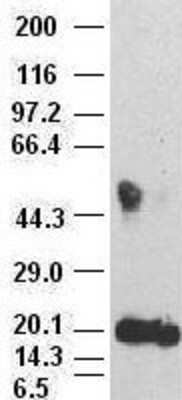 Western Blot: IL-6 Antibody (OTI3G9) [NBP1-47810]