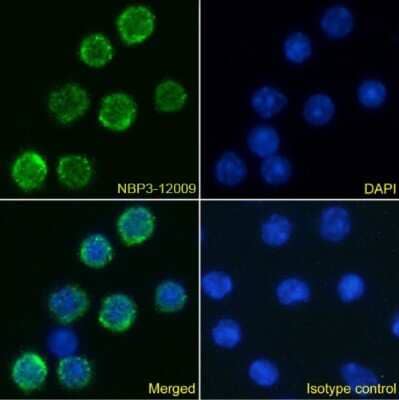 Immunocytochemistry/ Immunofluorescence: IL6R Antibody (D7715A7) - Chimeric - Azide and BSA Free [NBP3-12009]