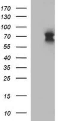 Western Blot: IL6R Antibody (OTI2F4)Azide and BSA Free [NBP2-71029]