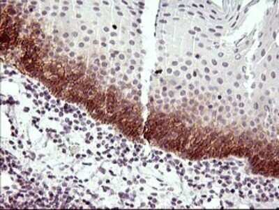 Immunohistochemistry-Paraffin: IL6R Antibody (OTI2F4) [NBP2-45414]
