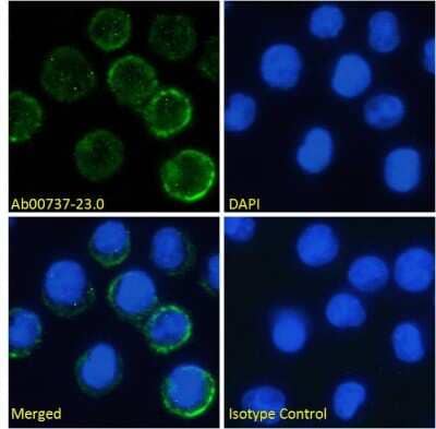 Immunofluorescence: IL6R Antibody (rhPM-1 (Tocilizumab)) - Chimeric - Azide and BSA Free [NBP2-75193]